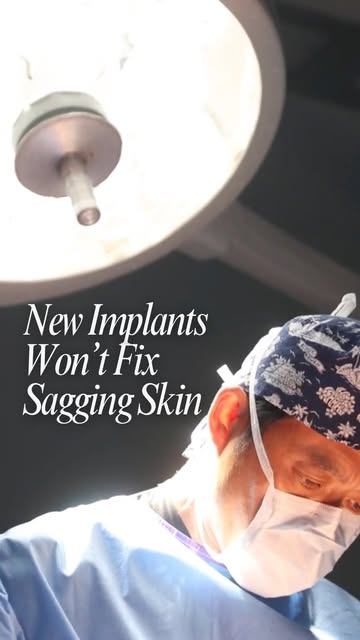 New implants alone won’t fix sagging skin. 

A lift repositions the tissue you already have reshapin