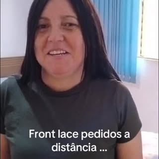 Depoimento de prótese enviada a distância . Avaliação presencial e por WhatsApp 11965570533 #alopeci