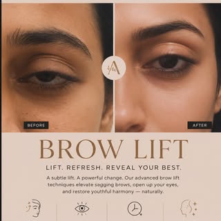 Brow lift , thread lift , Botox , dr Vikas Singh , ko clinics