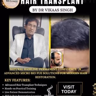 Micro bio fue hair transplant