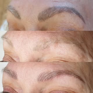 Os queremos recordar que el servicio de eliminación de tattos, micropigmentaciones y microblading co