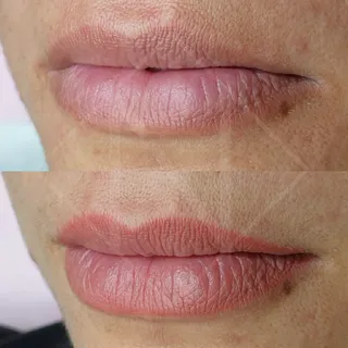 Labios bonitos y bien definidos des de que te levantas gracias la micropigmentación. 🥰

Cuando cura