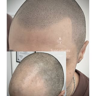 Hairline Chronicles🔥🔥🔥 2 sessions done with @5pm_shadow_pigments, 5pm shadow machine and 5pm shad