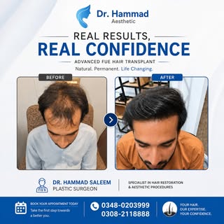#topplasticsurgeonforhairtrasnplant #bestfuehairtransplantinlahore #topplasticsurgeoninlahore