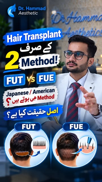 Chinese Method, Japanese Method, Korean Method… kya ye waqai different Hair Transplant methods hain?