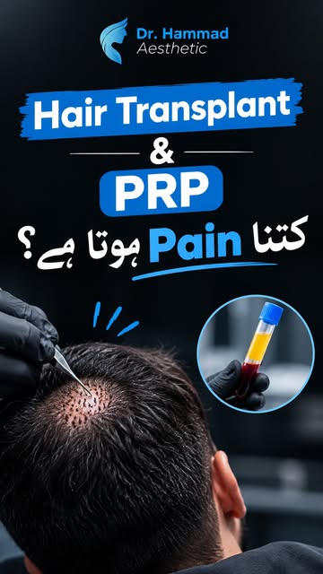 اکثر لوگ پوچھتے ہیں کہ Hair Transplant اور PRP کے دوران کتنا Pain ہوتا ہے؟