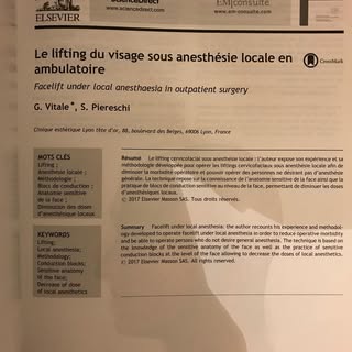Petit focus sur le lifting cervico-facial qui peut etre pratiqué sous anesthésie locale dont j’ai ex