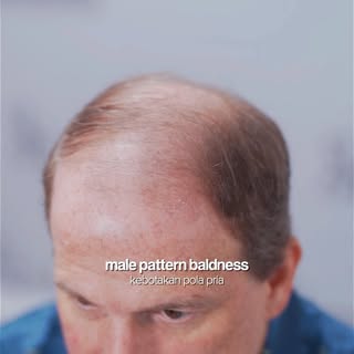 Rela jauh-jauh dari USA ke Jakarta untuk kembalikan rambut impiannya?!🫣
Kira-kira apa yaa yang memb