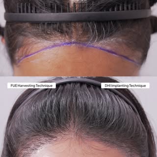 Baru 10 hari tapi baby hair sudah mulai tumbuh??😱😳

✅ Tanpa harus konsultasi offline
✅ Dengan tekn