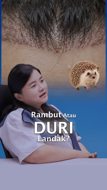Niatnya mau perbaiki garis rambut, tapi kok hasilnya malah kaku kayak duri landak?

Tonton penjelasa