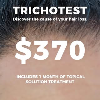 Struggling with hair loss? Discover the cause with Trichotest! 🔍 This genetic test helps identify t