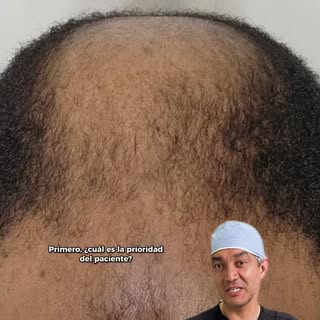 Dr. JC Alvarez explains how to determine if a case is viable for a hair transplant. 💇‍♂️🌱 Factors 