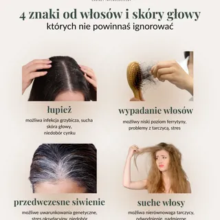 Twoje włosy i skóra głowy wysyłają sygnały - nie ignoruj ich ✨
Łupież, nadmierne wypadanie, suche wł