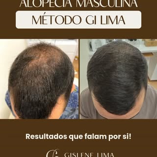 Antes e depois real!

Esse antes e depois mostra uma evolução de um tratamento, mas também reforça a