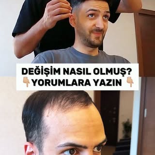 Sabitgaz 1 yaşına girdi 🎂 Primehair vesilesiyle bu güne özel yüzümü gösteriyorum!!! 😇

Primehair Y