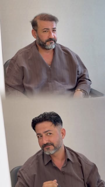 Değişimi izlemeye hazır mısınız? 🔥

Bazen tek bir dokunuş, görünümün tamamını değiştirir. Bu videod