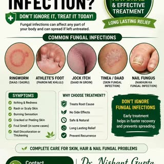 🍄 FUNGAL INFECTION? DON’T IGNORE IT!

Fungal infections can cause itching, redness, rashes, scaling
