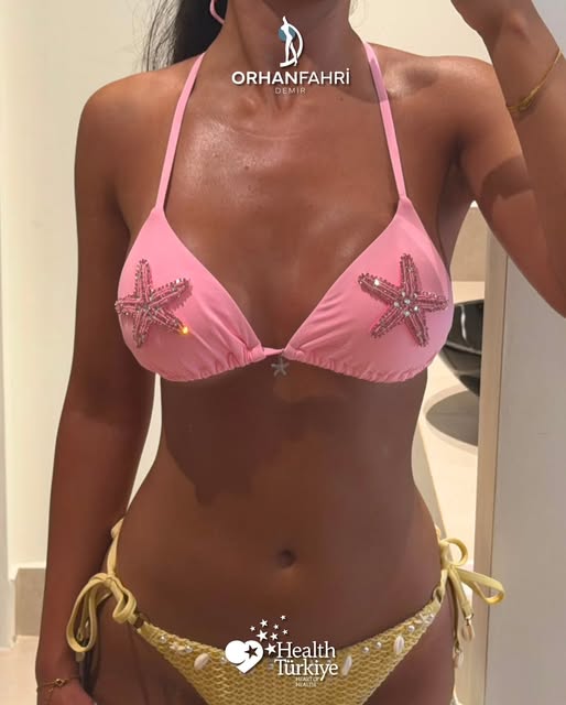 🇩🇪 Our patient who traveled from Germany

✨ 6-Month Follow-Up After Breast Implant Surgery

Sharin