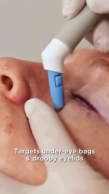 Tired of looking tired, even after a full night's sleep? 👀 Watch to the end.

Often it isn't your s
