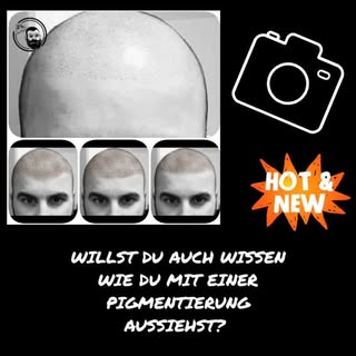 WILLST DU AUCH WISSEN WIE DU MIT EINER HAARPIGMENTIERUNG AUSSIEHST?

Kein Problem 😎👍

1. Schick un
