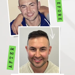 This before-and-after photo truly highlights the impressive transformation that can be achieved with