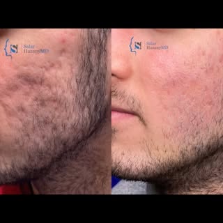 go to: www.shi.org for appointments or
call or text: (424)225-2453
Seeing a Video before/after like 