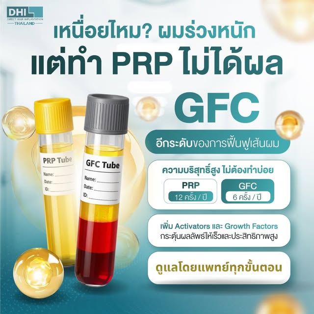 😔 ผมบาง ถ้า Growth Factor แบบธรรมดาๆไม่ได้ผลก็ต้องมีตัวช่วย!
ลดปัญหาผมร่วง ผมบางด้วย  𝗚𝗙𝗖 𝗛𝗮𝗶