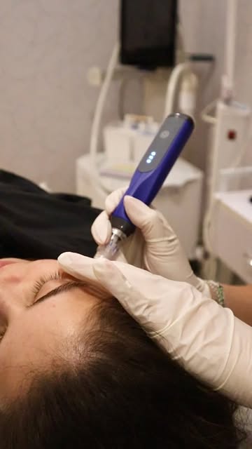 When skincare isn’t enough, it’s time to go deeper✨

SkinPen stimulates your skin’s natural healing 