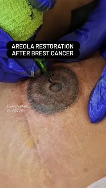 Areola Restoration After Brest Cancer is only solution for complete look after Brest implant 

Very 