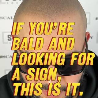 IF YOU’RE LOOKING FOR A SIGN, THIS IS IT. 

———————————————————

Scalp Micropigmentation is a hair t