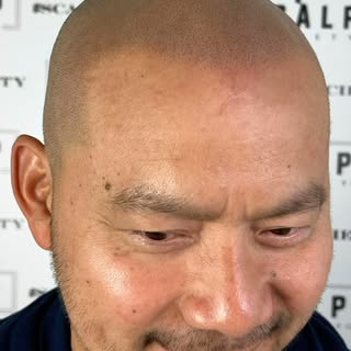 Let us know what type of hairline you’re looking for and some examples of work you liked. We’ll let 