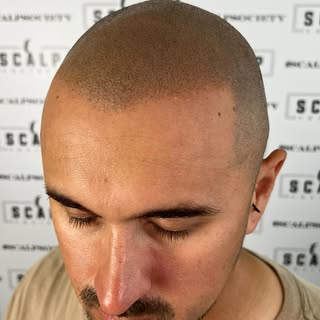 Natural finishes with a defined edgy look. Hair loss is a thing of the past ✌🏻 

——————————————

#s