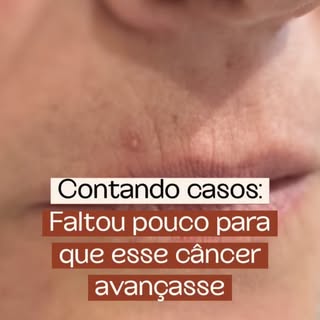 Muitas vezes, uma lesão pequena, que parece inofensiva, pode esconder algo mais sério.

É fácil pens