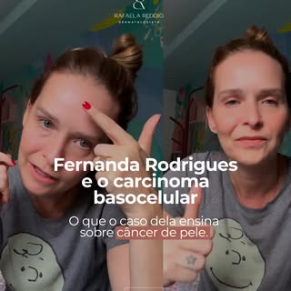 "Já tirei o câncer de pele, agora estou curado." Essa é uma frase que escuto com frequência no consu