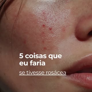 A rosácea vai muito além da vermelhidão. É uma doença inflamatória crônica que pode causar ardor, se