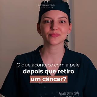 Receber o diagnóstico de um câncer de pele costuma gerar muitas dúvidas.

E uma delas quase sempre é
