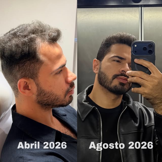 O antes e depois (4 meses) do meu tratamento capilar!

Comecei meu tratamento capilar em abril, por 