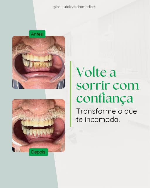Quando você consegue sorrir sem pensar duas vezes, tudo muda.

Não é só estética. É confiança para c