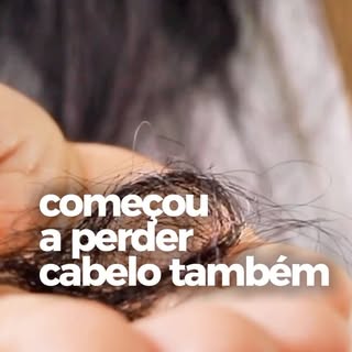 Tu emagreceu e, alguns meses depois, percebeu uma queda de cabelo muito mais intensa?

A perda rápid