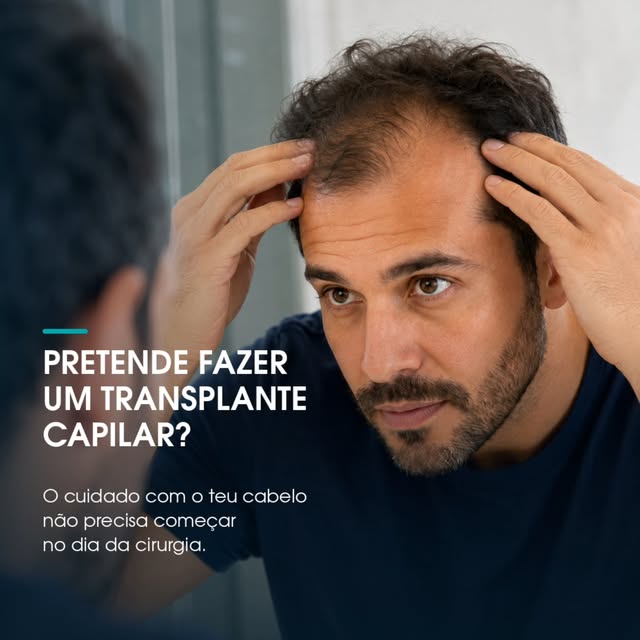 Transplante capilar exige cuidado antes e depois da cirurgia.

Para quem planeja realizar o procedim