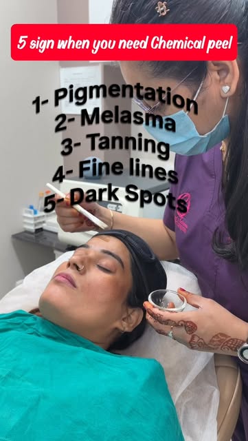 Chemical peeling for Melasma
#melasmatreatment #chemicalpeel #dermatologist #skinrejuvenation #drpri