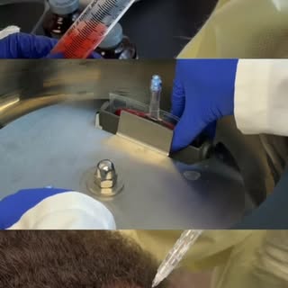 The prep. The process. The application. Protocol matters when it comes to your PRP treatments. Make 