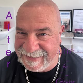 Before, During & After