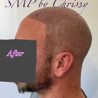 This request was a little different as he wanted the hairline to join straight to the beard line and