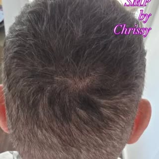 Density treatment over two sessions of around 4 hours each. Density completed around the top areas. 