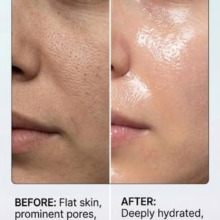 ✨ Say goodbye to tired, dull skin! ✨

Give your skin the care it deserves with deep cleansing and in