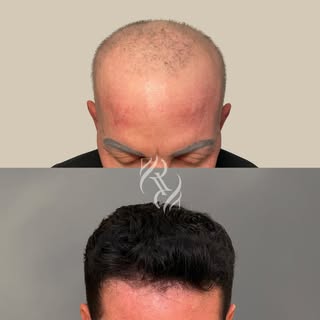 360° do toque Refinatto!

Para quem vê de fora, essa transformação pode parecer apenas estética.
Mas