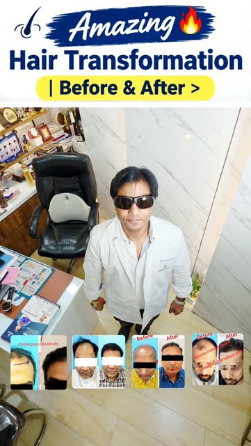 ​💇‍♂️ Amazing Hair Transplant Before & After Result! | Dr. Vijay Gupta
.
.
.
Kya aap bhi hair fall 