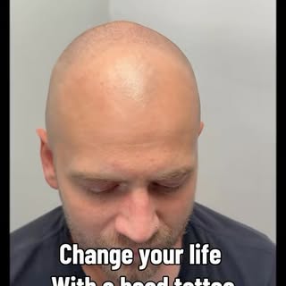 Let me change your life and bring back the confidence you once had . 

Hair loss sucks, no doubt abo