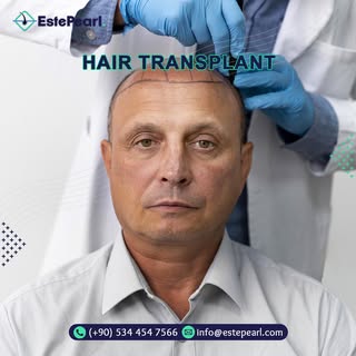 Hair transplant operations in Turkey, the best hair transplant crew, life-time guarantee.
.
.
 #hair